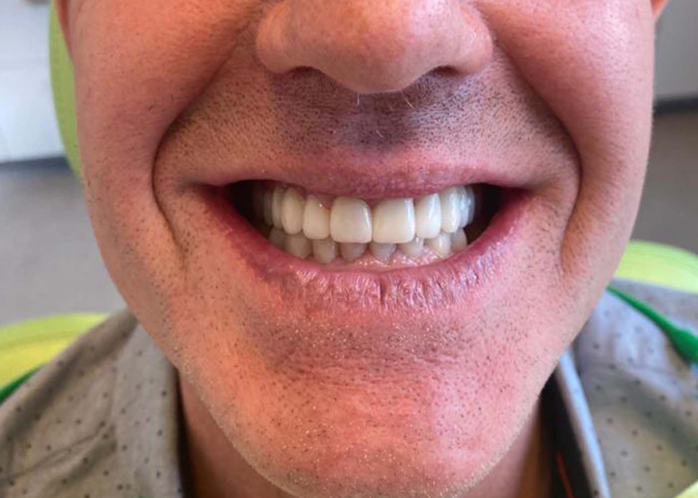 Dentelli Testimonials - F Young After
